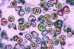 Measles virus
